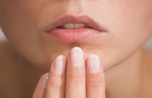 Симптомы и лечение молочницы во рту у взрослых мужчин и женщин в домашних условиях 