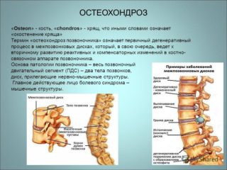 Боль в правом подреберье, отдающая в спину 