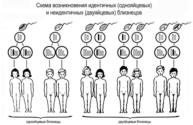 Многоплодная беременность: монохориальная и дихориальная двойня 