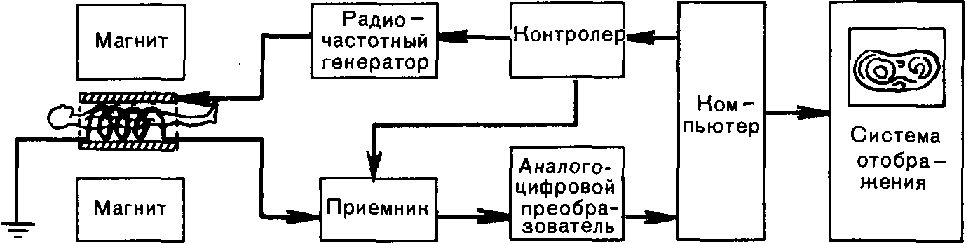 МРТ при беременности 