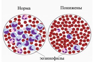 Норма эозинофилов в крови 