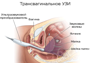 Ультразвуковое исследование на определение овуляции: разбираемся в тонкостях 