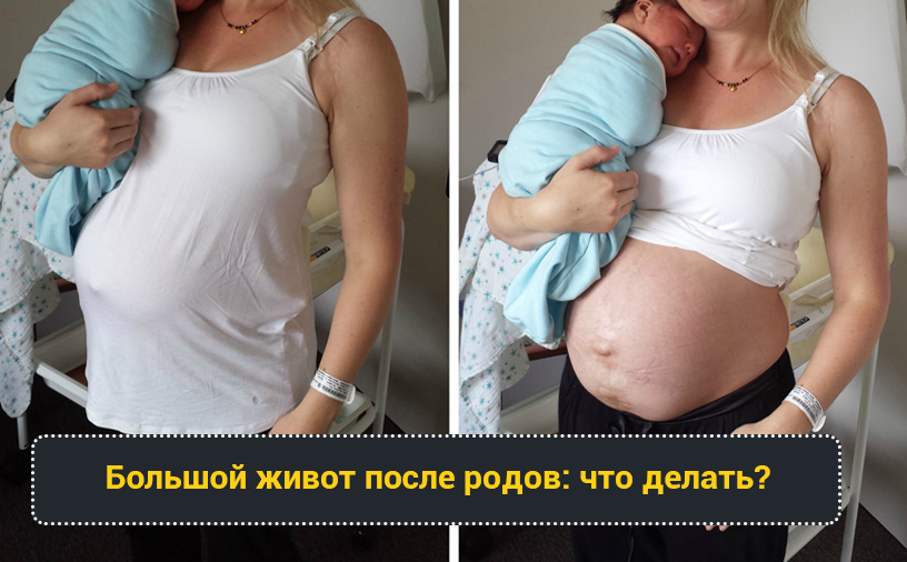 Живот после родов 