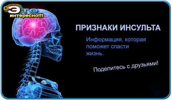 Инсульт: симптомы, первая помощь и виды реабилитации 