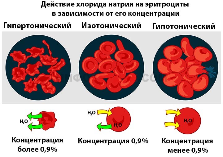 Как приготовить и когда применять гипертонический раствор соли 