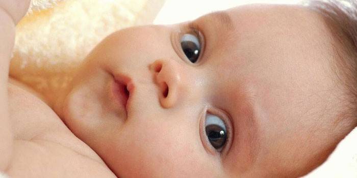 Внутричерепное давление у грудничков и новорожденных 