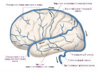Затруднение венозного оттока головного мозга 