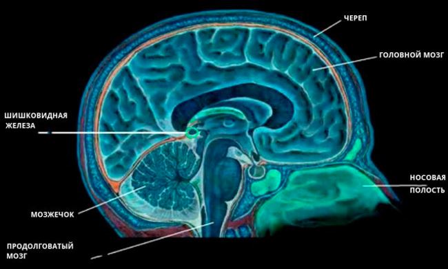 Что собой представляет шишковидная железа 