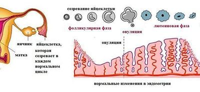 Эндокринное бесплодие у женщин 