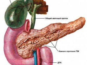 Хронический билиарный панкреатит: насколько опасным является заболевание 