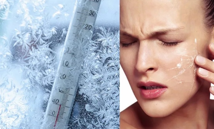 9 лучших кремов для лица зимой 