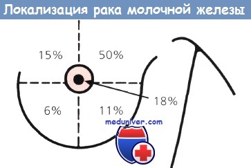 Пальпация молочной железы — выявляем опухоль в домашних условиях 