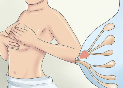 Правильное сцеживание и массаж груди при лактостазе 