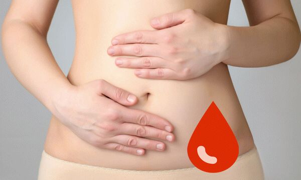 Причины и способы остановки кровотечения при эндометриозе 