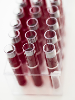 Проведения анализа крови на пролактин: норма и отклонения 