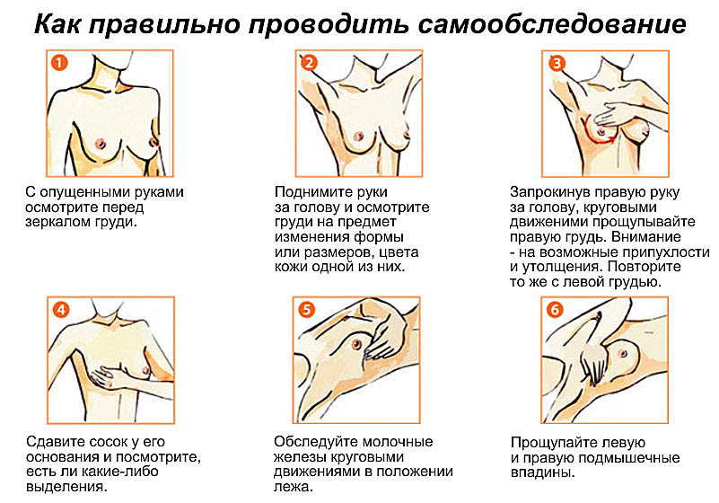 Важные правила самообследования молочных желез 