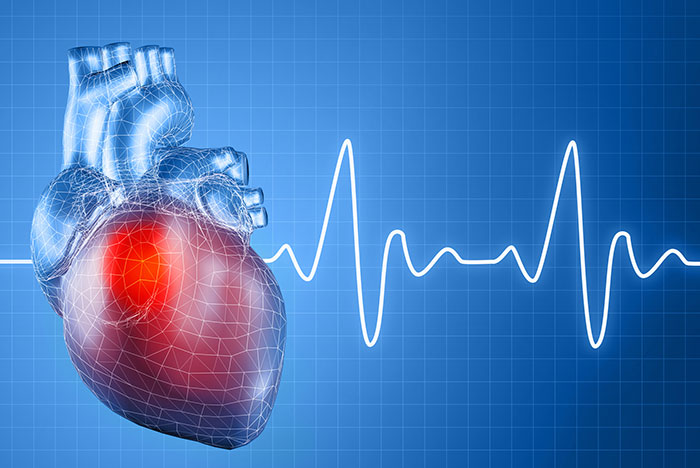 Аритмия сердца: причины, признаки и лечение 