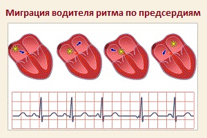 Что такое миграция водителя ритма 