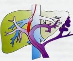 Причины возникновения и развития портальной гипертензии 