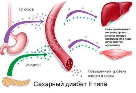 Диета при сахарном диабете 2 типа 