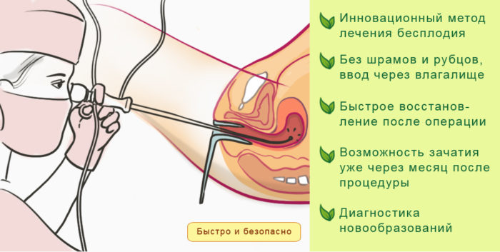 Беременность после гистероскопии 