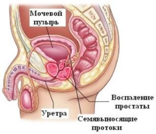 Что показывает КТ при обследовании малого таза у женщин 