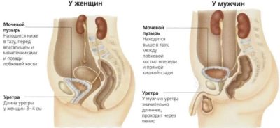 Что такое бужирование, для чего оно нужно, виды расширителей уретры 