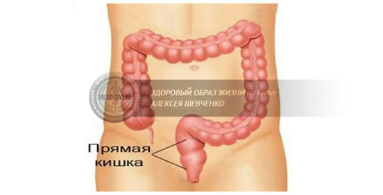 Диета при paке прямой кишки — каким должно быть правильное питание 