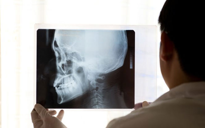 Для чего проводят рентген черепа и турецкого седла? 